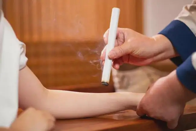 艾灸和拔罐的注意事項！